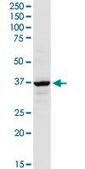 Anti-AACS antibody produced in rabbit purified immunoglobulin, buffered aqueous solution