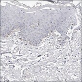 Anti-RSPO2 antibody produced in rabbit Prestige Antibodies® Powered by Atlas Antibodies, affinity isolated antibody, buffered aqueous glycerol solution