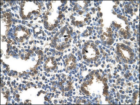 Anti-SLC37A3 antibody produced in rabbit affinity isolated antibody