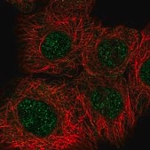 Anti-RAD50 antibody produced in rabbit Prestige Antibodies&#174; Powered by Atlas Antibodies, affinity isolated antibody, buffered aqueous glycerol solution