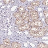 Anti-A1CF antibody produced in rabbit Prestige Antibodies&#174; Powered by Atlas Antibodies, affinity isolated antibody, buffered aqueous glycerol solution
