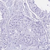 Anti-CGB3 antibody produced in rabbit Prestige Antibodies® Powered by Atlas Antibodies, affinity isolated antibody, buffered aqueous glycerol solution