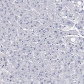 Anti-PARVB antibody produced in rabbit Prestige Antibodies&#174; Powered by Atlas Antibodies, affinity isolated antibody, buffered aqueous glycerol solution