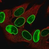 Anti-ZNF665 antibody produced in rabbit Prestige Antibodies® Powered by Atlas Antibodies, affinity isolated antibody, buffered aqueous glycerol solution
