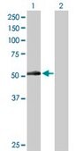 Anti-PNPLA3 antibody produced in rabbit purified immunoglobulin, buffered aqueous solution