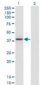 Monoclonal Anti-PARVG antibody produced in mouse clone 4E1, purified immunoglobulin, buffered aqueous solution