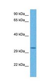 Anti-RG9MTD3 (AB1) antibody produced in rabbit affinity isolated antibody