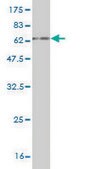 Monoclonal Anti-EXOSC3 antibody produced in mouse clone 5C3, purified immunoglobulin, buffered aqueous solution
