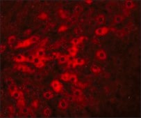 Anti-TMEM70 antibody produced in rabbit affinity isolated antibody, buffered aqueous solution