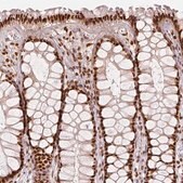 抗-KDM5B 兔抗 Prestige Antibodies&#174; Powered by Atlas Antibodies, affinity isolated antibody, buffered aqueous glycerol solution
