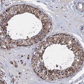 Anti-TIMM10 antibody produced in rabbit Prestige Antibodies&#174; Powered by Atlas Antibodies, affinity isolated antibody, buffered aqueous glycerol solution