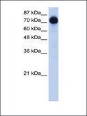 Anti-ZNF16 (AB1) antibody produced in rabbit affinity isolated antibody