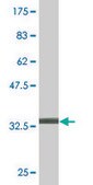 Monoclonal Anti-CMTM4, (C-terminal) antibody produced in mouse clone 1B9, purified immunoglobulin, buffered aqueous solution