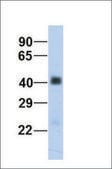 Anti-SGCB antibody produced in rabbit affinity isolated antibody
