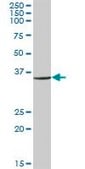 Anti-RPL6 antibody produced in mouse purified immunoglobulin, buffered aqueous solution