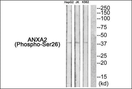 Anti-phospho-ANXA2 (pSer26) antibody produced in rabbit affinity isolated antibody