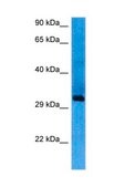 Anti-SIX1 affinity isolated antibody