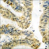Anti-phospho-AFX (pSer197) antibody produced in rabbit affinity isolated antibody