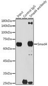 [KO Validated]Anti-Smad4 Antibody, clone 1H7D3, Rabbit Monoclonal