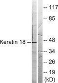 Anti-Keratin 18 antibody produced in rabbit affinity isolated antibody