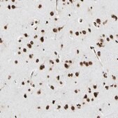 Anti-HNRNPK antibody produced in rabbit Prestige Antibodies&#174; Powered by Atlas Antibodies, affinity isolated antibody, buffered aqueous glycerol solution