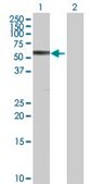 Anti-CBS antibody produced in rabbit purified immunoglobulin, buffered aqueous solution