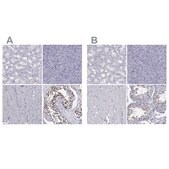 Anti-PPM1G antibody produced in rabbit Prestige Antibodies® Powered by Atlas Antibodies, affinity isolated antibody, buffered aqueous glycerol solution