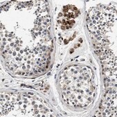 Anti-PDP1 antibody produced in rabbit Prestige Antibodies&#174; Powered by Atlas Antibodies, affinity isolated antibody, buffered aqueous glycerol solution