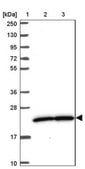 Anti-PRKRIP1 antibody produced in rabbit Prestige Antibodies® Powered by Atlas Antibodies, affinity isolated antibody, buffered aqueous glycerol solution