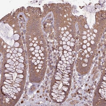 Anti-TIGD7 antibody produced in rabbit Prestige Antibodies&#174; Powered by Atlas Antibodies, affinity isolated antibody, buffered aqueous glycerol solution