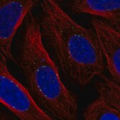 Anti-DPY19L1 antibody produced in rabbit Prestige Antibodies&#174; Powered by Atlas Antibodies, affinity isolated antibody, buffered aqueous glycerol solution