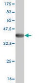 Monoclonal Anti-ADAMTS17 antibody produced in mouse clone 3B7, purified immunoglobulin, buffered aqueous solution