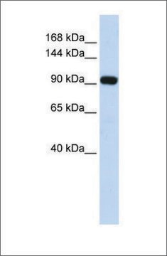 Anti-EVI1 (ab2) antibody produced in rabbit affinity isolated antibody