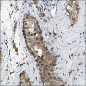 Anti-WHSC1 antibody produced in rabbit Prestige Antibodies® Powered by Atlas Antibodies, affinity isolated antibody, buffered aqueous glycerol solution