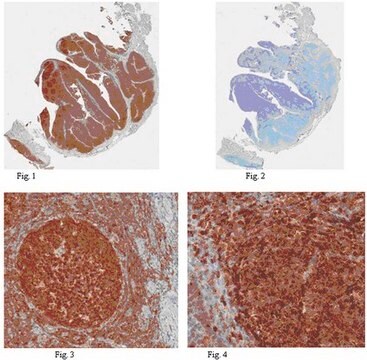 Anti-HPK1 Antibody from rabbit