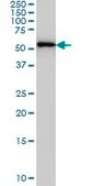 Monoclonal Anti-FARSLA antibody produced in mouse clone 2D8, purified immunoglobulin, buffered aqueous solution