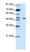 Anti-KCNAB2 (AB1) antibody produced in rabbit affinity isolated antibody