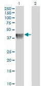 Monoclonal Anti-BGN antibody produced in mouse clone 4E1-1G7, purified immunoglobulin, buffered aqueous solution