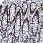 Anti-SIM2 antibody produced in rabbit Prestige Antibodies® Powered by Atlas Antibodies, affinity isolated antibody, buffered aqueous glycerol solution