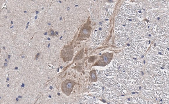 Anti-MRGPRX4 Antibody, clone 3F4 ZooMAb&#174; Rabbit Monoclonal recombinant, expressed in HEK 293 cells