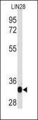 Monoclonal Anti-LIN28A antibody produced in mouse IgG fraction of antiserum, buffered aqueous solution
