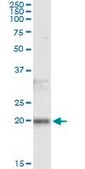 Monoclonal Anti-FTL antibody produced in mouse clone 4C10, purified immunoglobulin, buffered aqueous solution