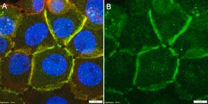 Anti-CTNND1/p120CTN Antibody, clone 2C22 ZooMAb® Rabbit Monoclonal recombinant, expressed in HEK 293 cells