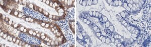 Anti-Integrin &#946;4 Antibody, clone 3D11 ZooMAb&#174; Rabbit Monoclonal recombinant, expressed in HEK 293 cells