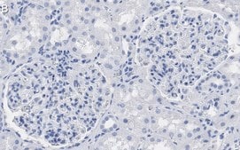Anti-Wilms Tumor Protein Antibody, clone 2O18 ZooMAb® Rabbit Monoclonal recombinant, expressed in HEK 293 cells