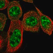 Anti-CYSRT1 antibody produced in rabbit Prestige Antibodies® Powered by Atlas Antibodies, affinity isolated antibody, buffered aqueous glycerol solution, Ab2