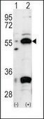 Anti-PDX1 (N-term) antibody produced in rabbit IgG fraction of antiserum, buffered aqueous solution