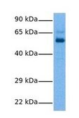 Anti-CPEB2 (AB1) antibody produced in rabbit affinity isolated antibody