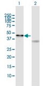 Anti-SIRT7 antibody produced in rabbit purified immunoglobulin, buffered aqueous solution