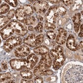 Anti-CYP1B1 antibody produced in rabbit Prestige Antibodies&#174; Powered by Atlas Antibodies, affinity isolated antibody, buffered aqueous glycerol solution